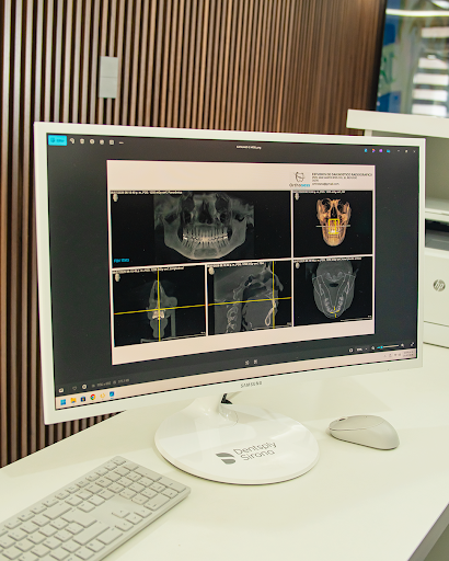 Proceso de captura Axeos