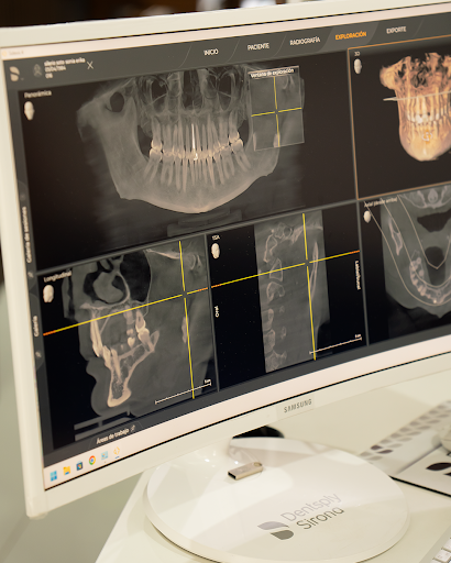 Plataforma de visualización para dentistas