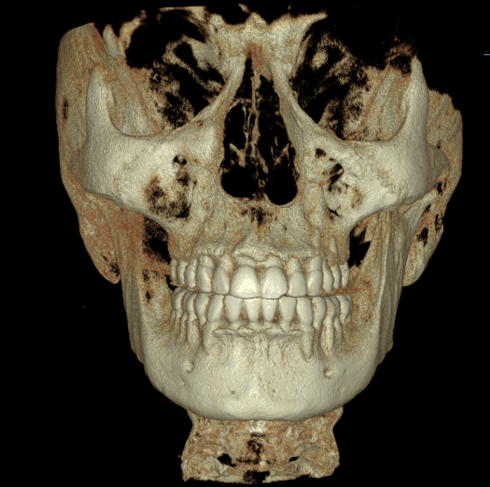 Tomografía Axeos - Diagnóstico Dental 3D de Alta Resolución